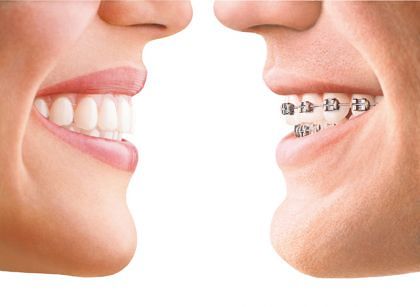 Zahnspange Praxis für Kieferorthopädie Dr. Baumann St. Gallen