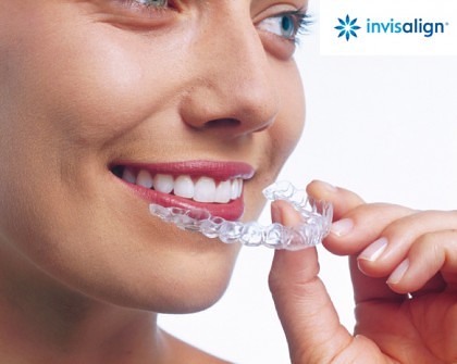 Unsichtbare Zahnspange Invisalign | Dr. Baumann Kieferorthopädie St. Gallen