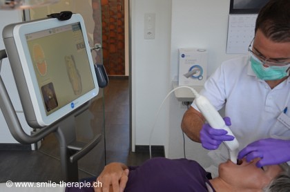  iTero Element new intraoral scanner from Align technology Dr. Baumann Kieferorthopädie St. Gallen Switzerland http://www.smile-therapie.ch